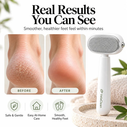 VelaClean™ Precision Heel File